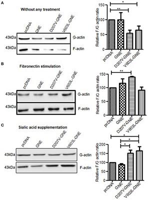 Altered Actin Dynamics in Cell Migration of GNE Mutant Cells